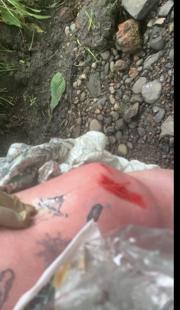 blood on knee
crystal hand poked tattoo
ice berg hand poked tattoo
virus hand poked tattoo